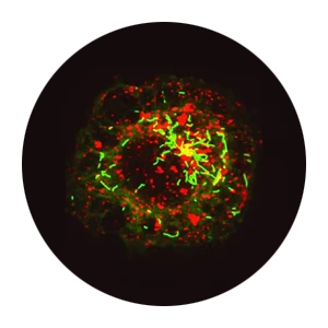 Macrophage (NLRP3)